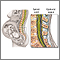 Epidural - Serie