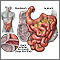 Intestino delgado