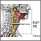 Tratamiento de la epilepsia