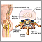 Disco intervertebral