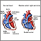 Doble salida ventricular derecha