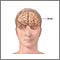 Anatomía de un cerebro normal