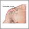 Bursitis del hombro