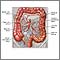 Suministro sanguíneo al intestino grueso