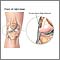 Ligamento colateral externo