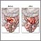 Antes y después de anastomosis del intestino delgado