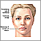 Caída facial