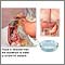 Cultivo del tejido duodenal