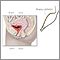 Biopsia ureteral