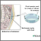 Cultivo peritoneal