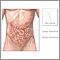 Lombrices intestinales