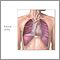 Cavidad pleural
