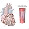 Stent de arteria coronaria